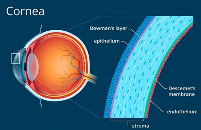 关于角膜塑形镜和角膜重塑你需要知道的事情