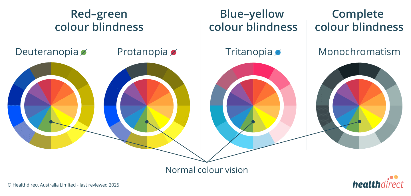 eye-colour-blindness-diagram (Source: https://www.healthdirect.gov.au/colour-blindness)