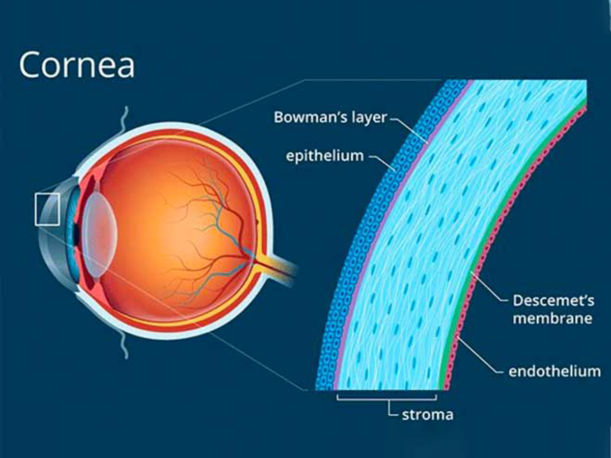 Things To Know About Ortho K Lenses And Corneal Reshaping 