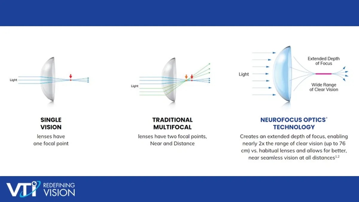 vision of mfcls