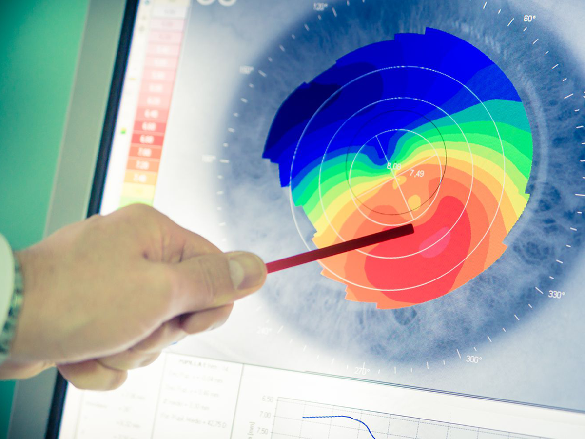 Clear Vision Ahead: Why Regular Eye Pressure Screening Matters for Your Ageing Parents