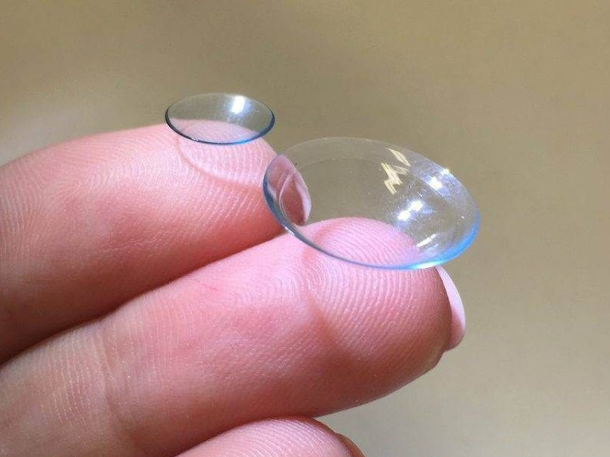 A Clearer Vision: Scleral Lenses as a Non-Surgical Solution for Corneal Scarring