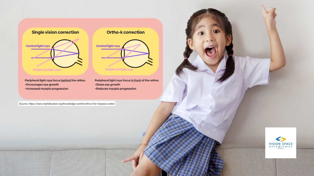 single vision correction and ortho-k correction