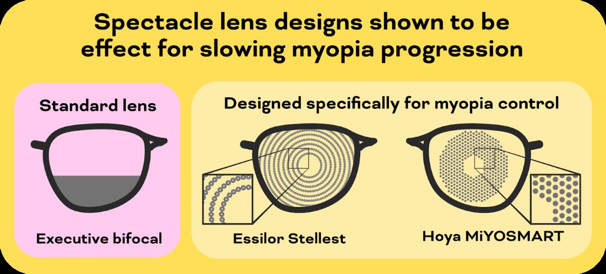 spectacle lens designs for myopia control