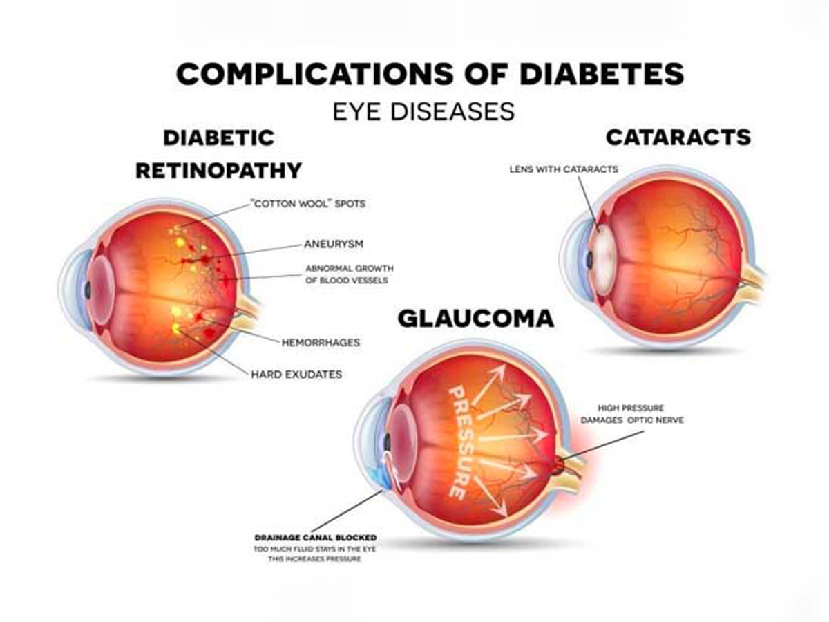 A Regular Eye Check Up Can Keep You Away From Vision Impairment